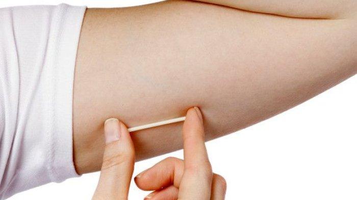 Pemasangan Implan Pada Seseorang Untuk Kepuasan Sendiri