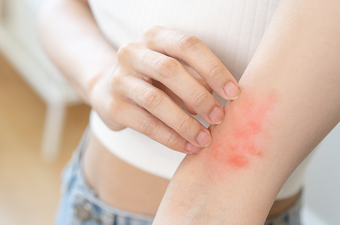 Kondisi Alergi Maupun Gatal Di Sebabkan Oleh Banyak Hal