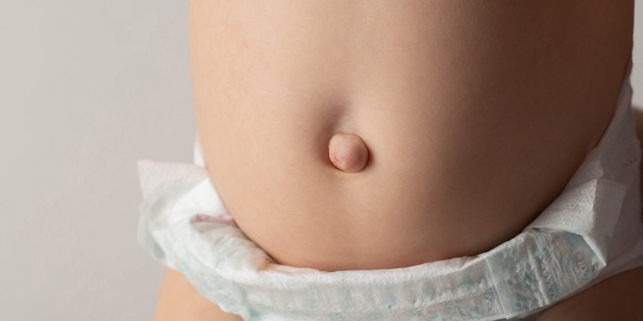 Jangan Kecolongan! Ada Jenis Hernia Anak Selain Di Pusar