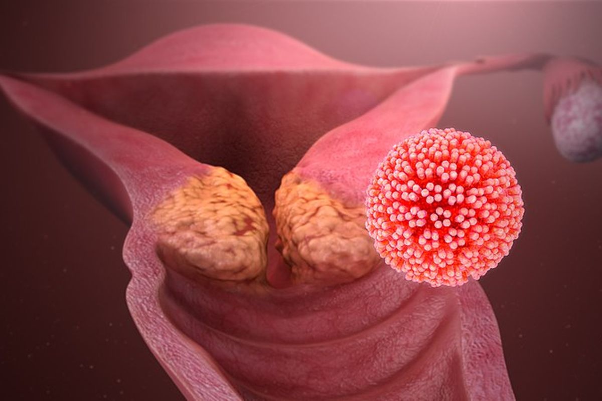 Kupas Tuntas HPV: Mengapa Ini Bukan Sekadar Masalah Seks?